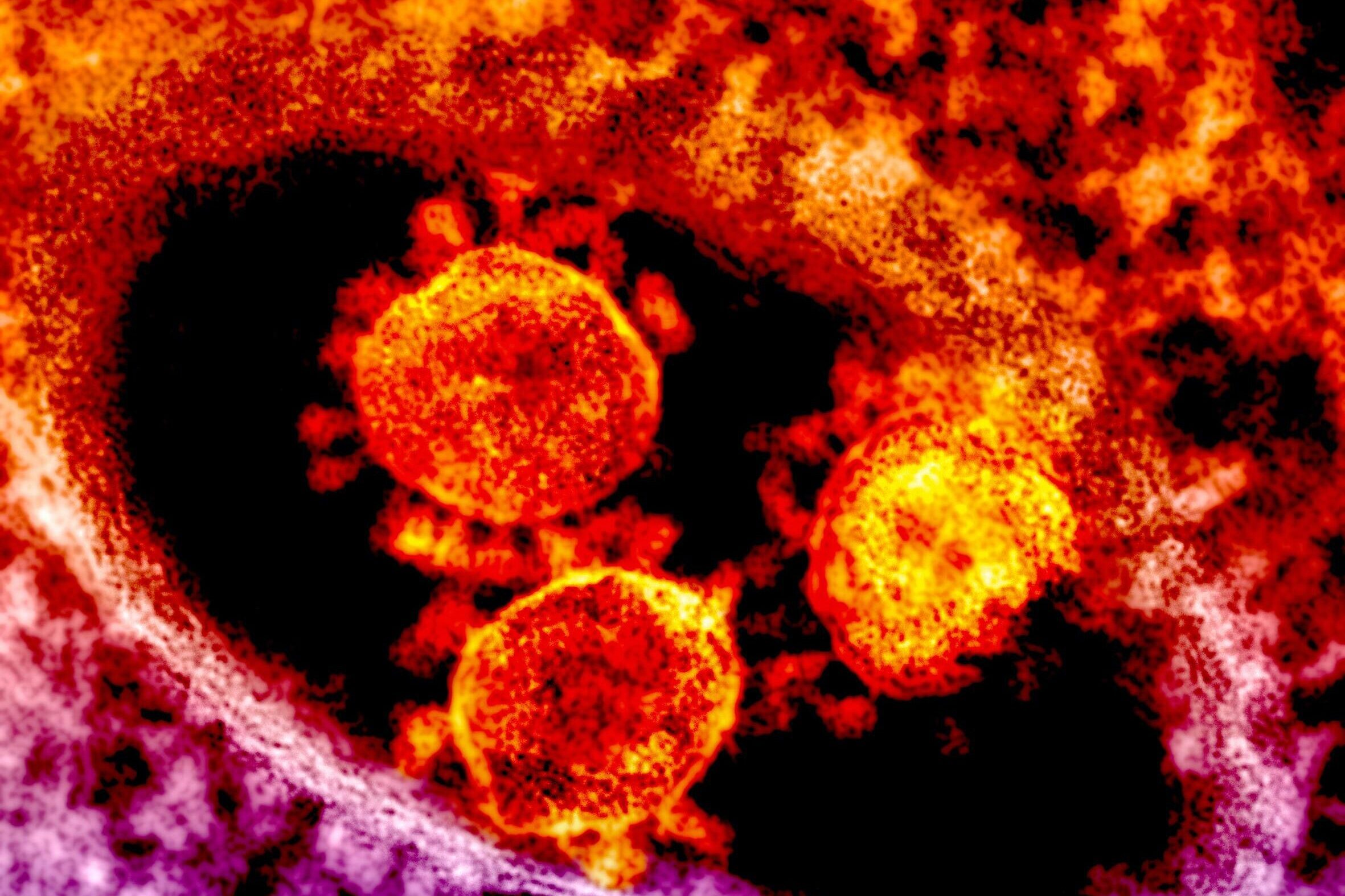 Pandemic causing Pathogens