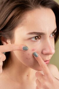 Skin problems during Rain Skin problems during Rain